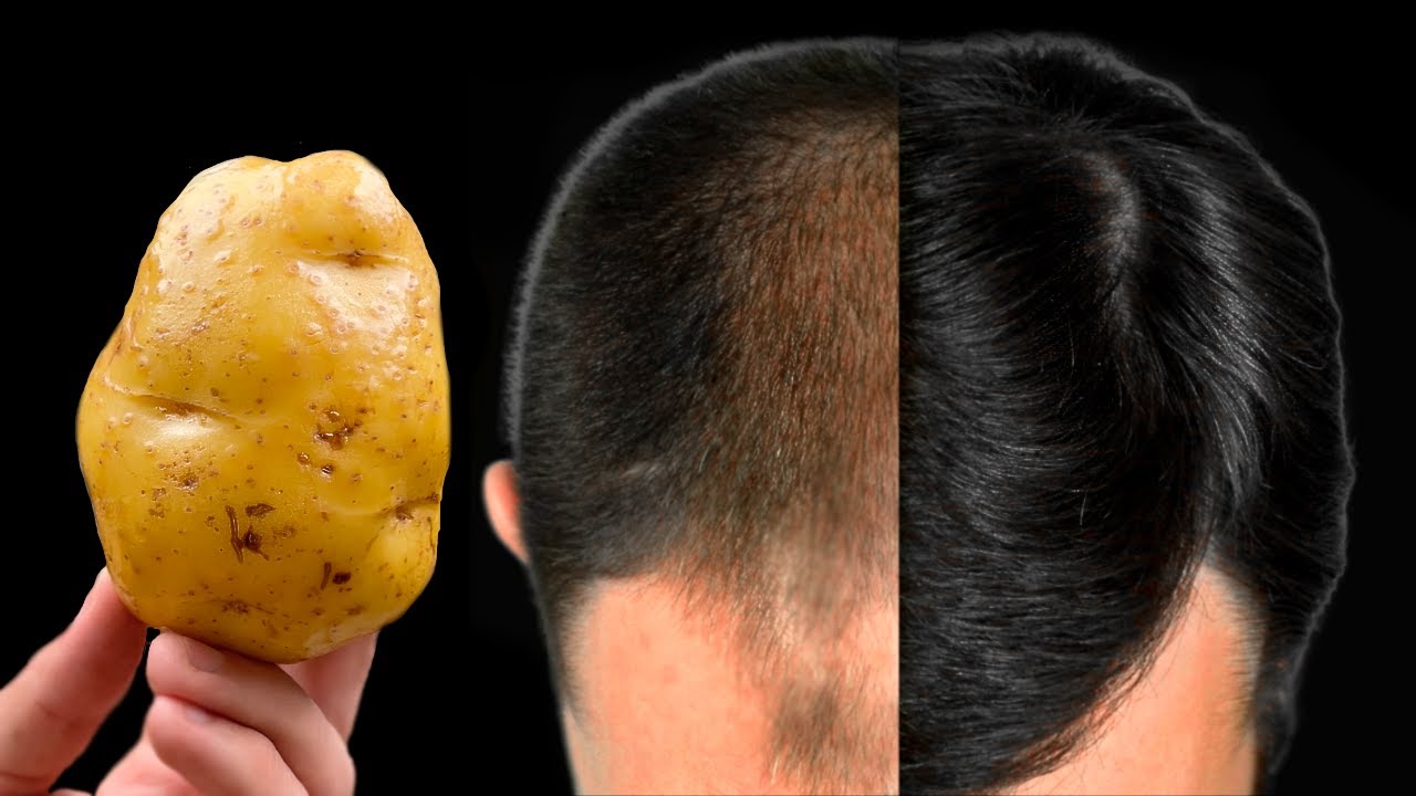 The Secret to Luxurious Hair: Potatoes