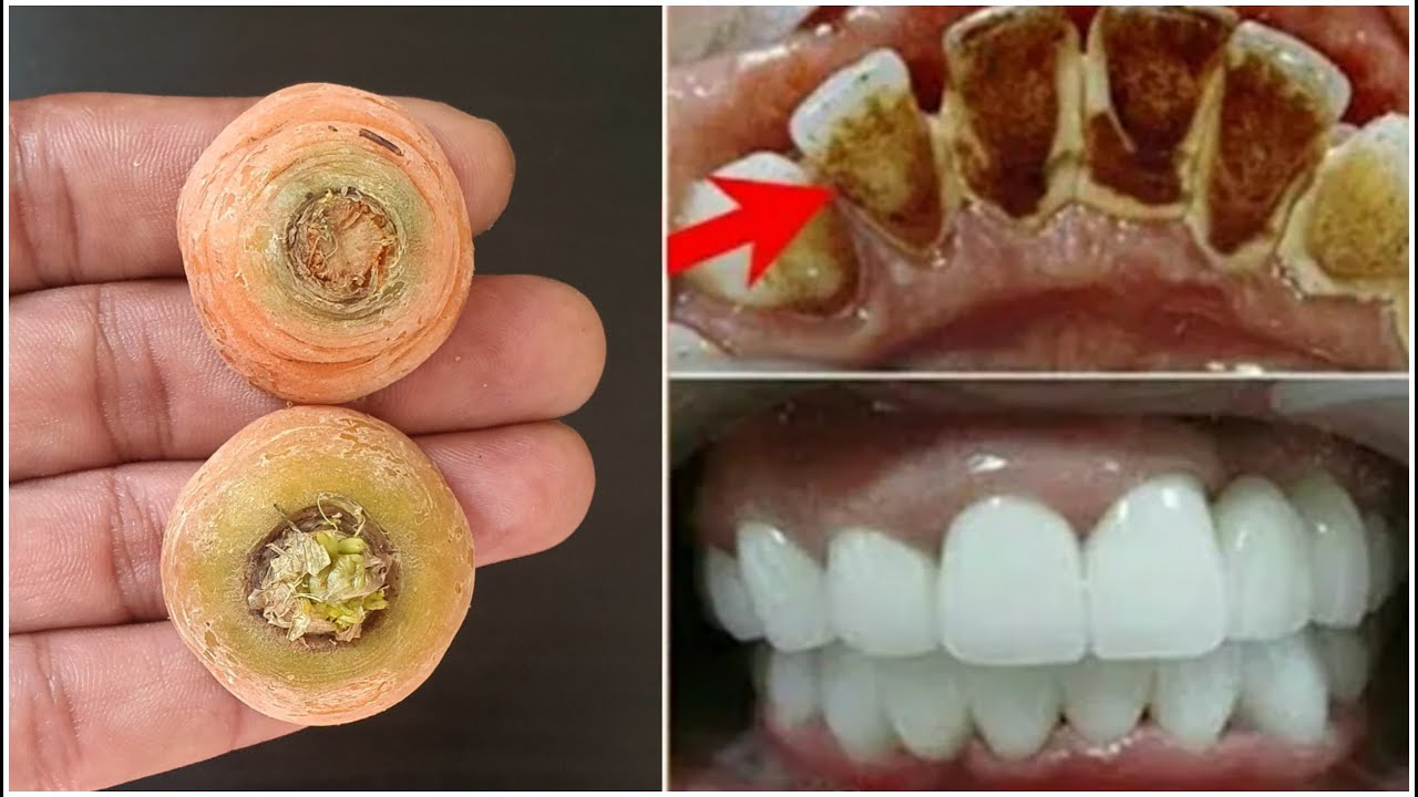 Carrot and Lemon Toothpaste: A Natural Solution for a Brighter Smile