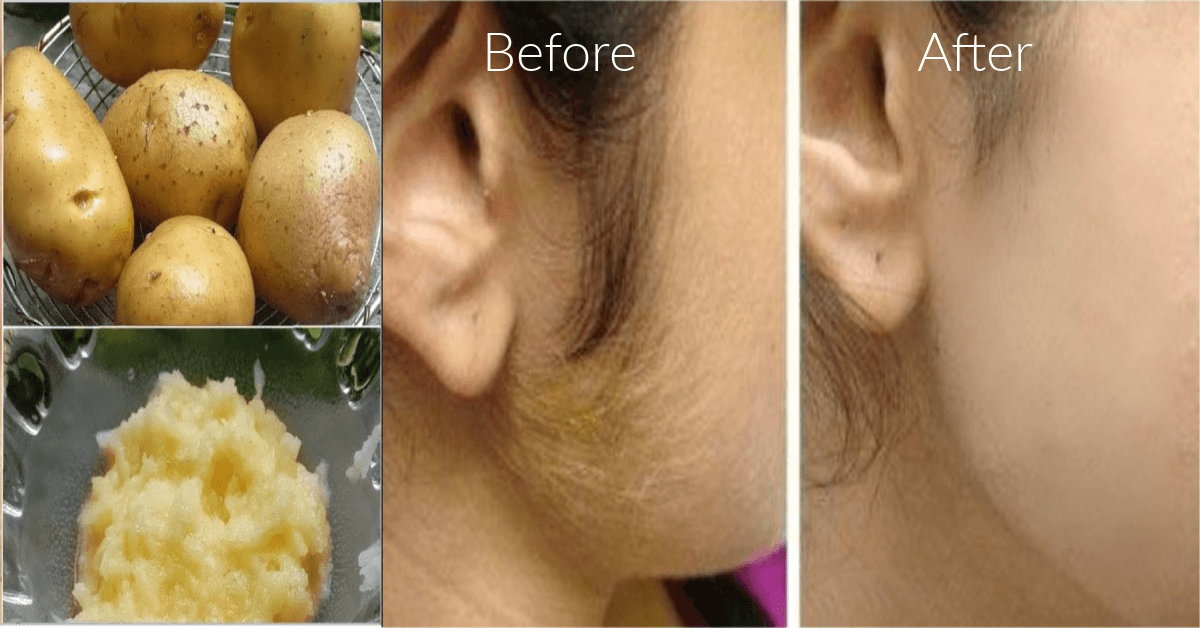 Discover the Gentle Power of Potato in Removing Facial Hair