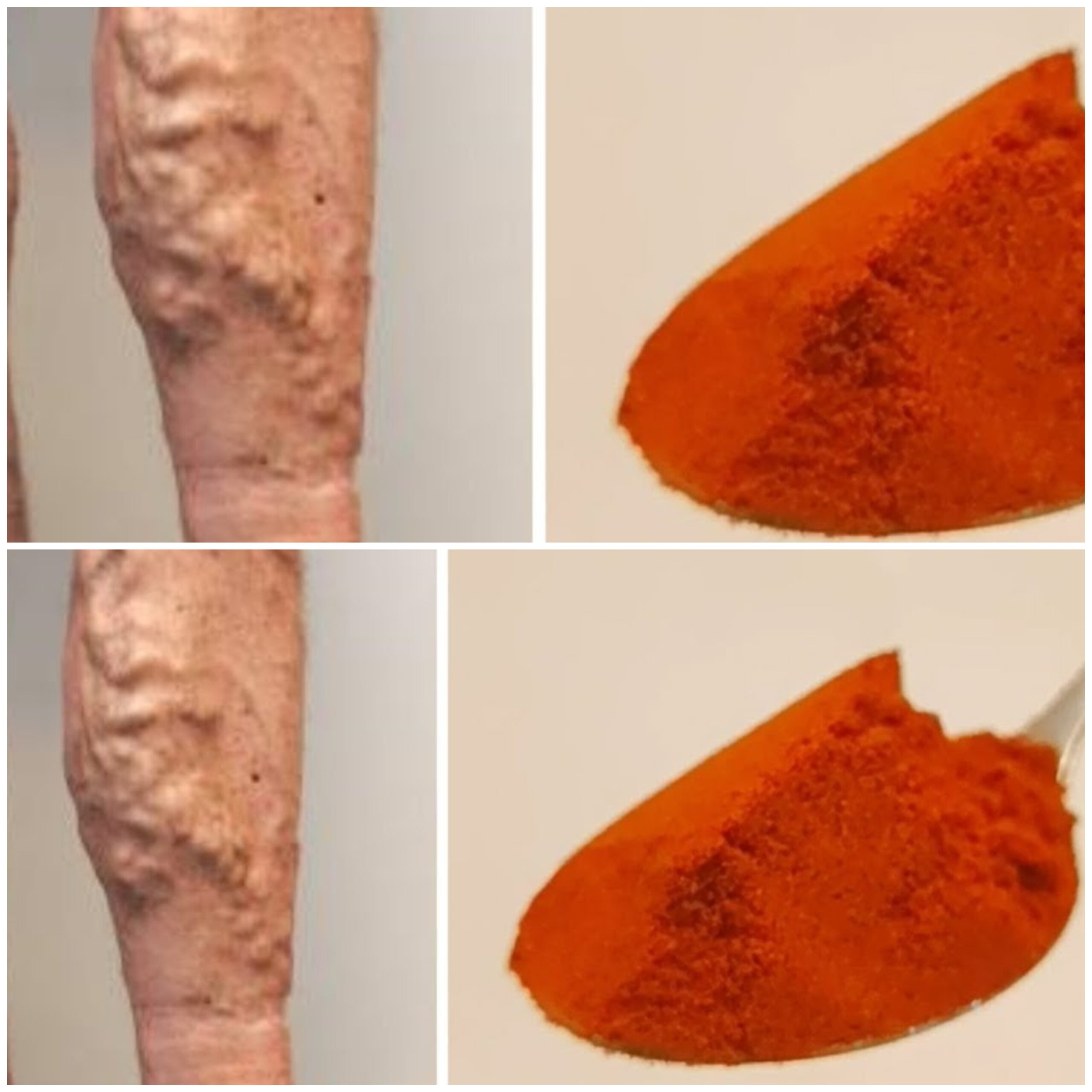 The Spicy Secret to Circulation: Cayenne Pepper’s Natural Cure