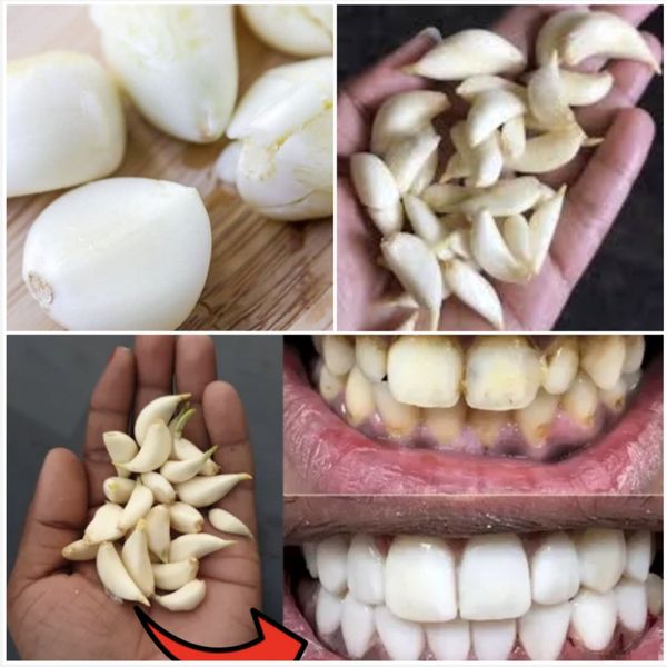 Unlocking a Healthier, Whiter Smile with the Power of Garlic