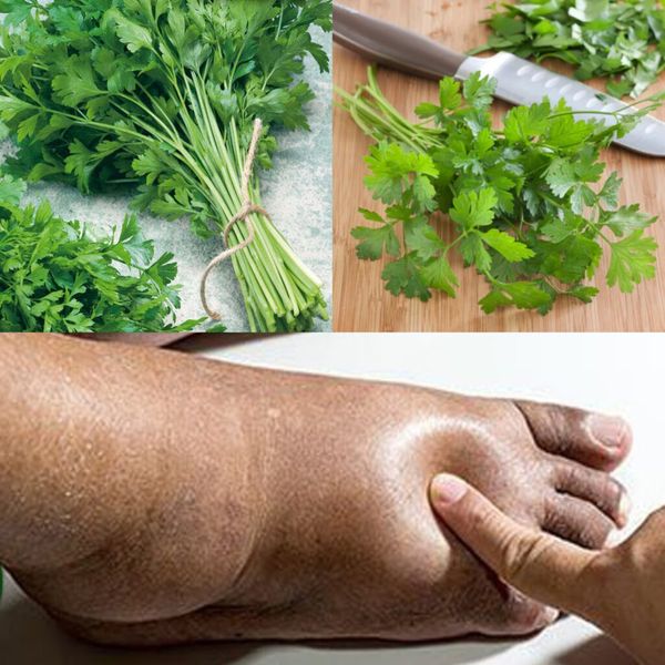 Say Goodbye to Swollen Hands and Feet with the Power of Parsley