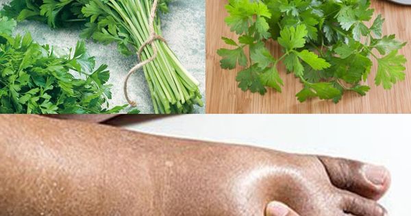 A Natural Way to Lessen Water Retention with Parsley